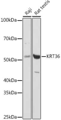 Western Blot: Keratin 36 AntibodyAzide and BSA Free [NBP3-03706]